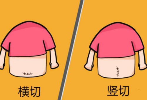 结扎后可以做试管婴儿吗,结扎做试管婴儿要注意什么